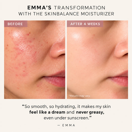 Crème hydratante SkinBalance