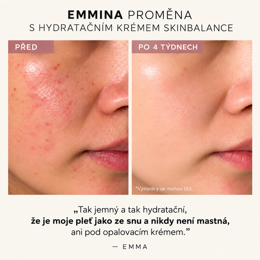 Hydratační krém SkinBalance